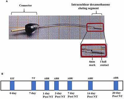 Otoprotection to Implanted Cochlea Exposed to Noise Trauma With Dexamethasone Eluting Electrode